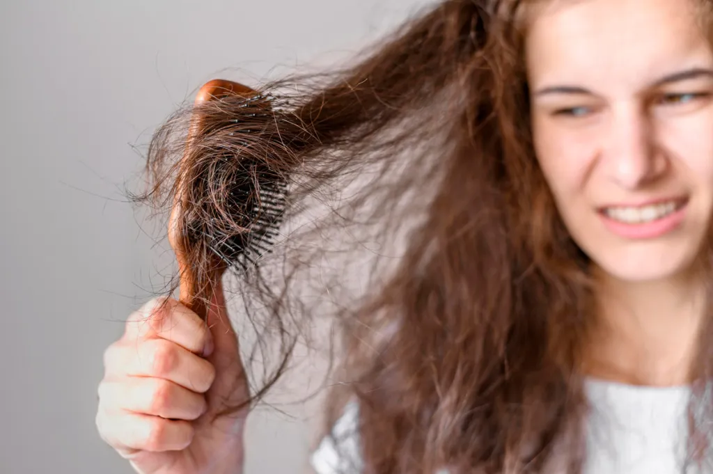 perdita dei capelli